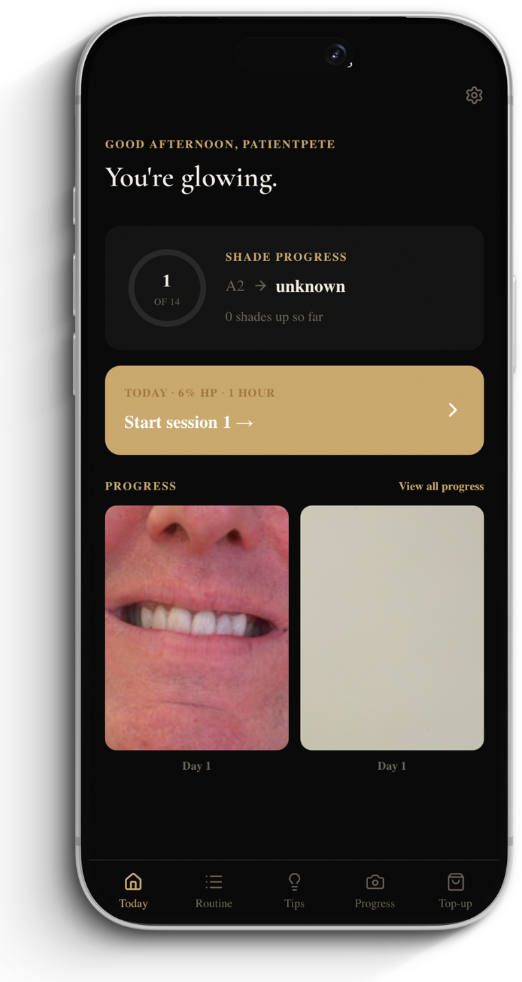 The 360 Whitening app — your daily whitening routine